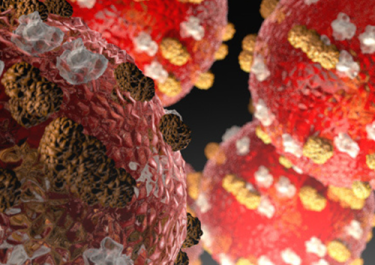 Image of a microscopic view of the Measles Virus